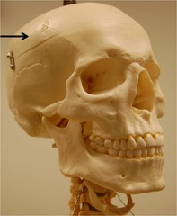 Name this bone.