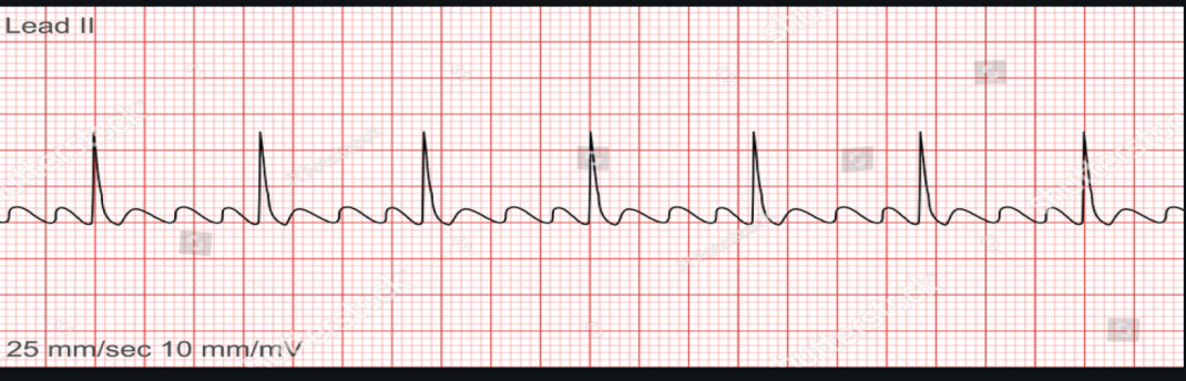 <p>ECG interpretation</p>