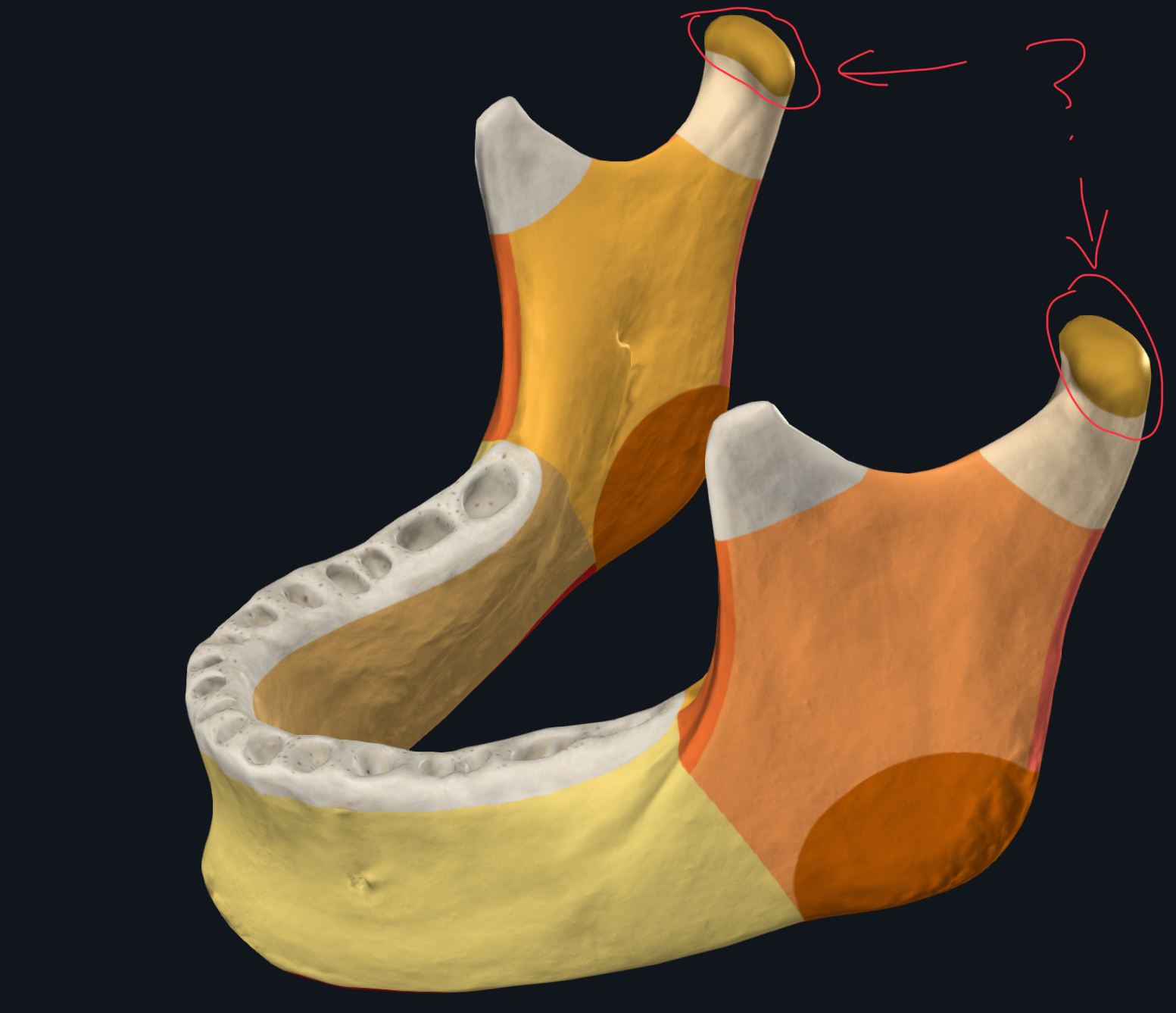 term image