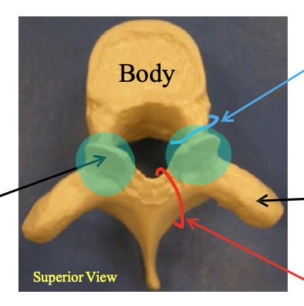 <p>Identify the group that this vertebrae belongs to. Then, identify the highlighted structure.</p>