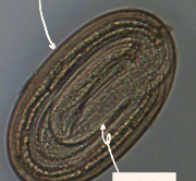 <p>Which stage of larvae is this? </p>