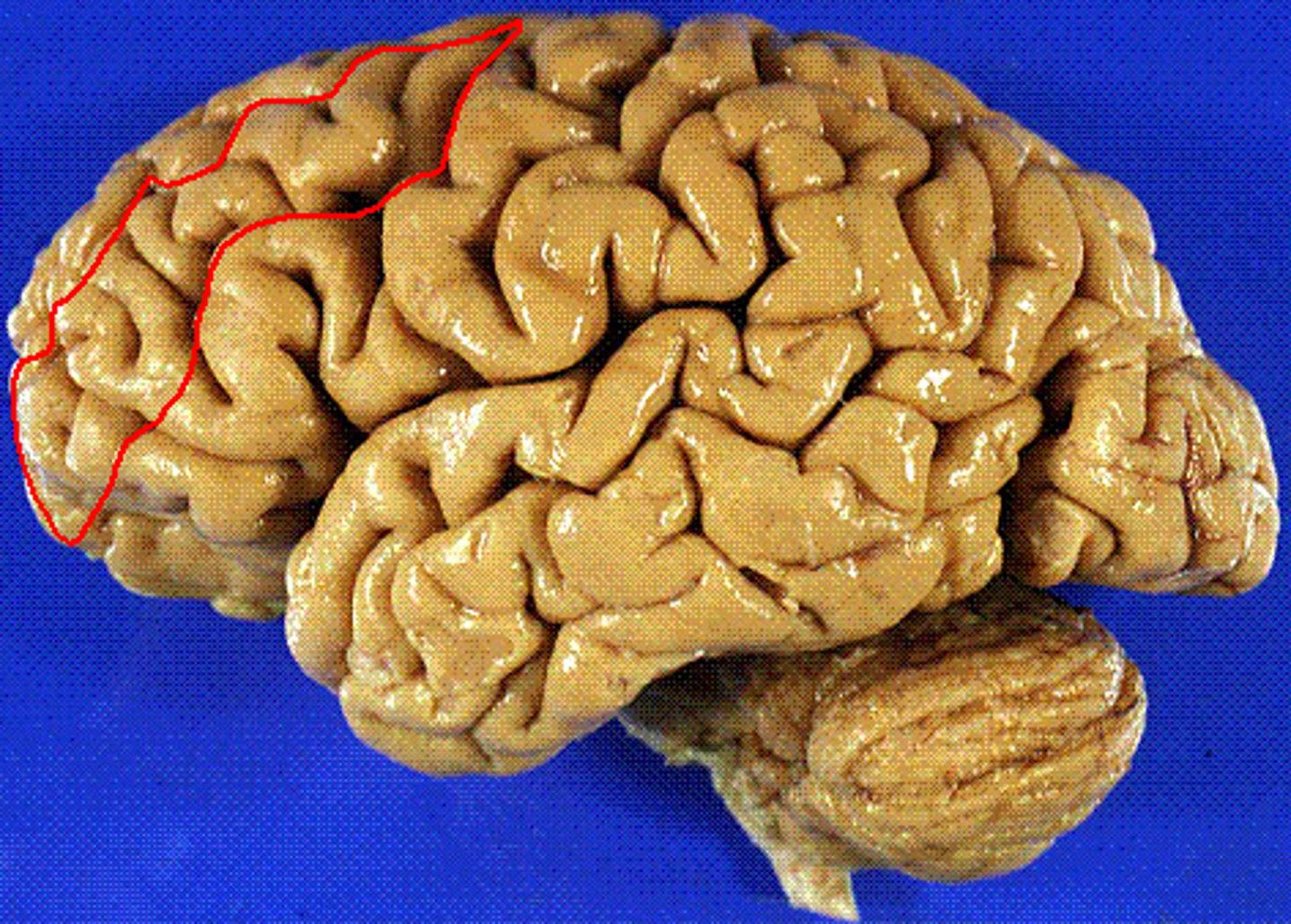 <p>the frontal lobe gyrus that is located between the superior and inferior frontal gyri</p>