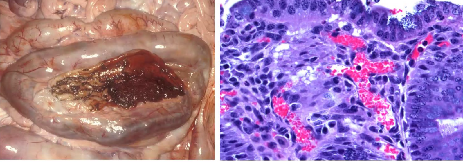 <p>Calf. What is the condition?</p><p>A-Enterotoxigenic colibacillosis</p><p>B-Coccidiosis</p><p>C-Cryptsporid iosis</p><p>D-Attaching effacing colibacillosis</p>