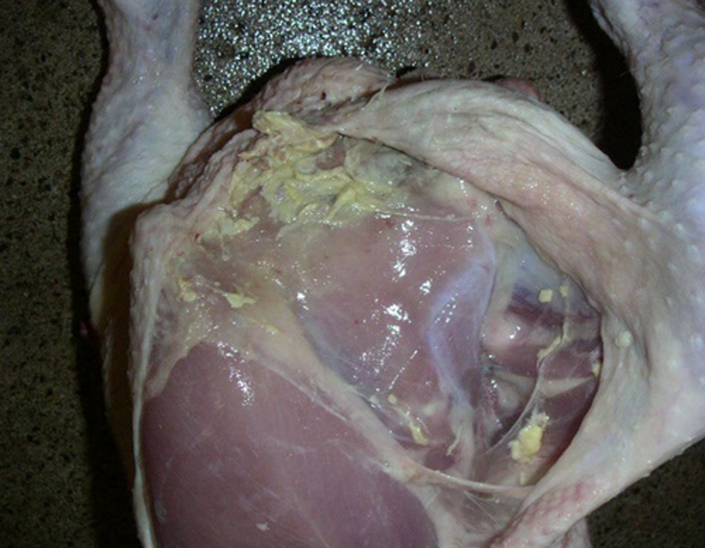 <p>door E. coli ontsteking </p><p>- ontsteking tussen vel en vlees</p><p>- gele substantie </p><p>kip</p>