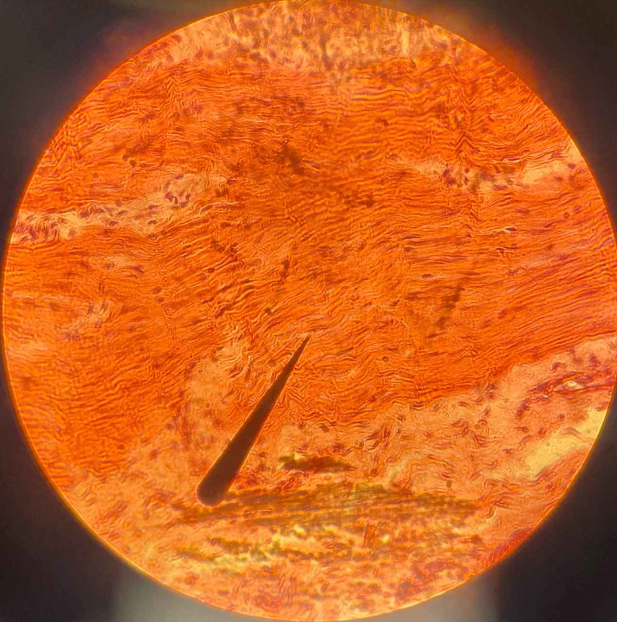 <p>example: epidermis of skin<br>function: protects from abrasion</p>