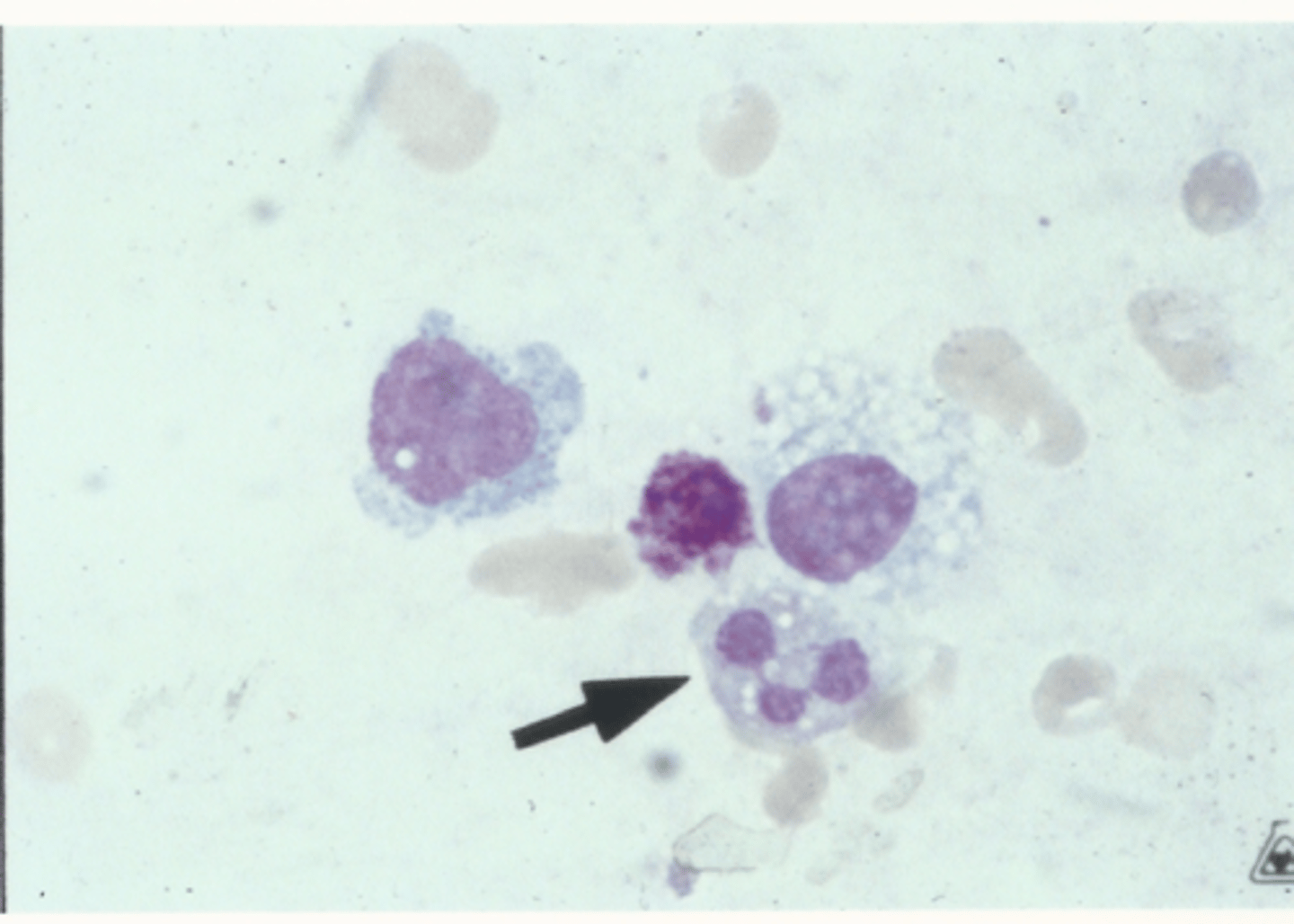<p>Identify the cells in this body fluid</p>