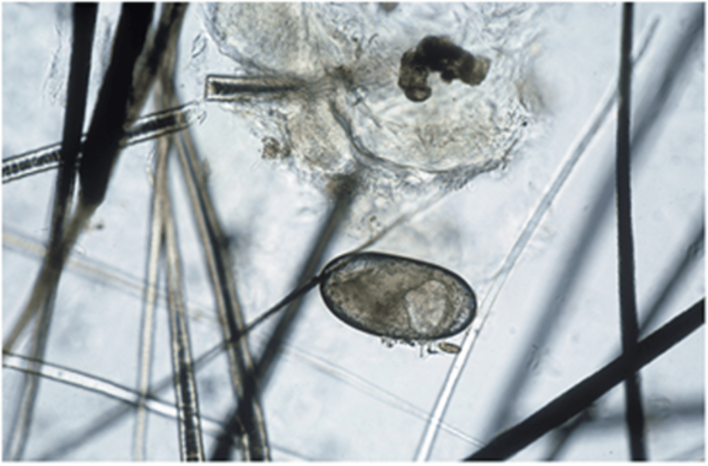<p>It is important to note that scabies mites are:</p>