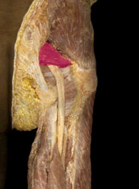 <p>inferior to medius, deep to maximus, see it medial to psoas major</p>