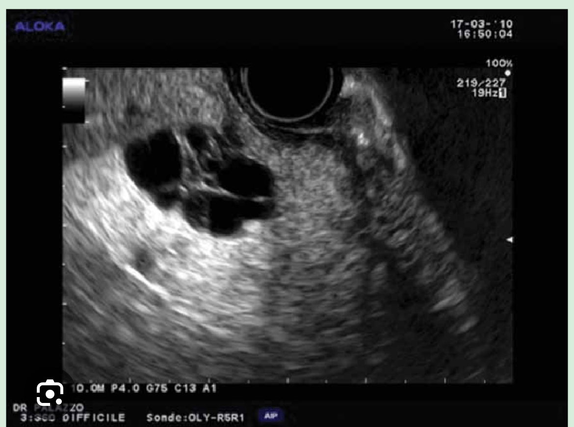 <p>Epithelial</p>