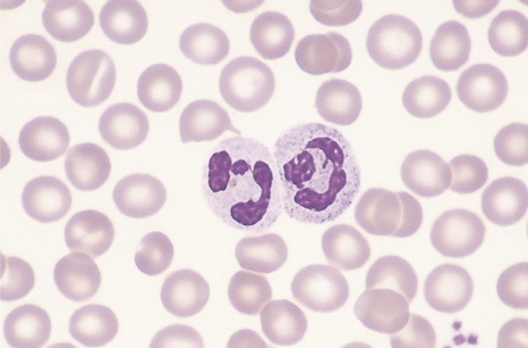 <p>Nuetrophil is part of the innate immunity: </p><ul><li><p>Make up <strong>50–70%</strong> of white blood cells in blood</p></li><li><p>Main job: </p><ul><li><p><strong>phagocytosis</strong> (they eat and destroy invaders)</p></li></ul></li><li><p>Have a <strong>multi-lobed nucleus</strong> (3–6 lobes)</p></li><li><p>Granules in their cytoplasm <strong>don’t stain strongly</strong>—they look neutral</p></li></ul><p></p>