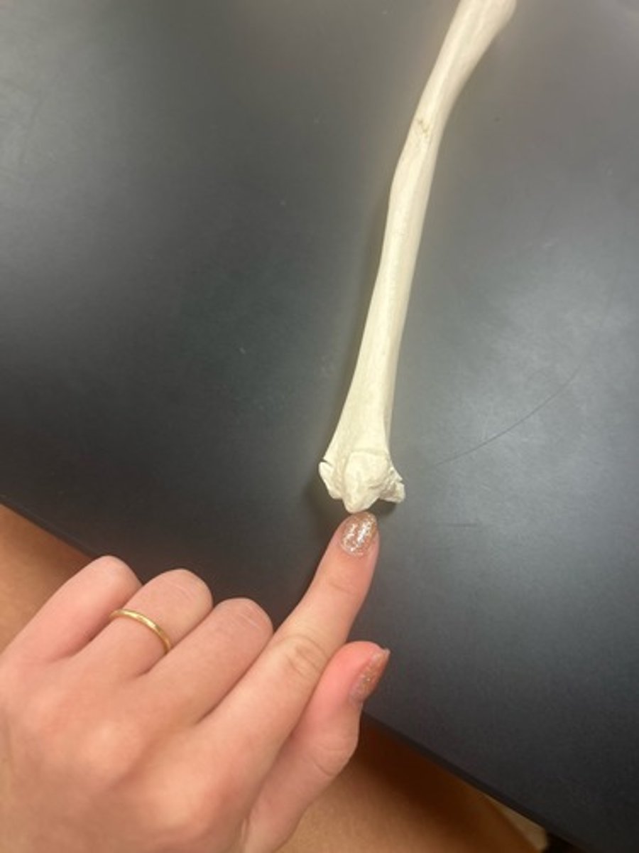 <p>name the bone</p>
