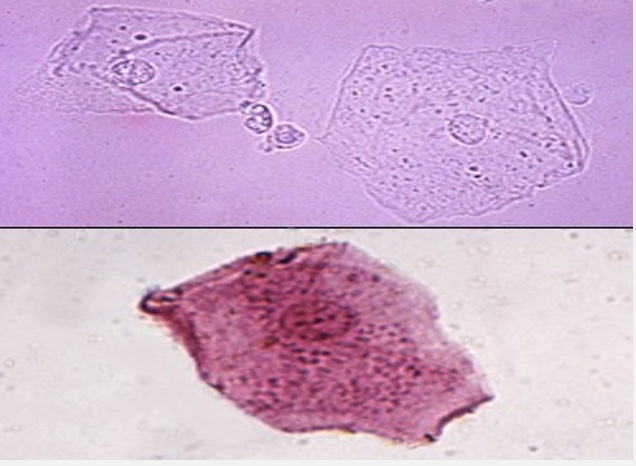 term image