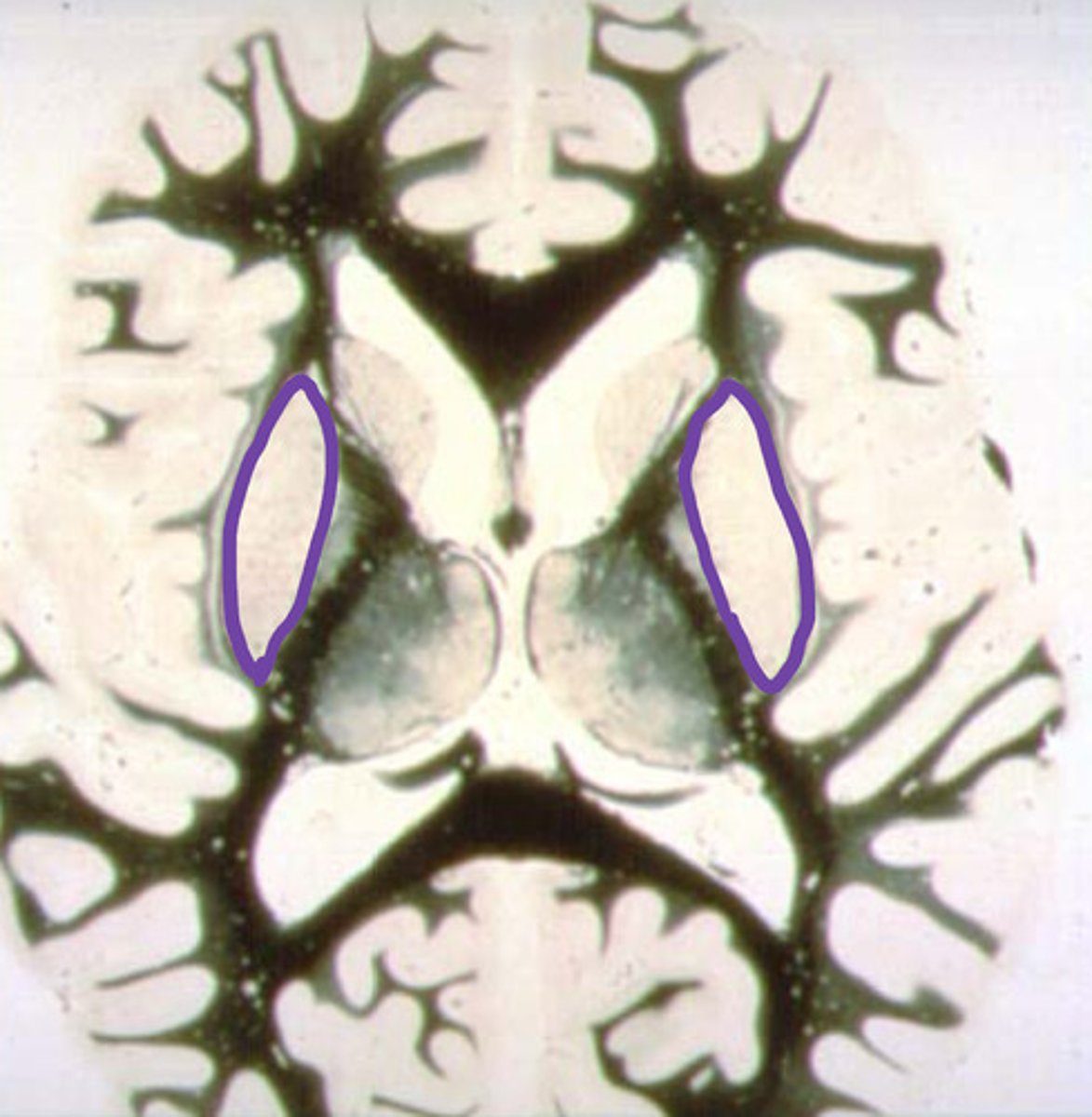 <p>identify the structure</p>