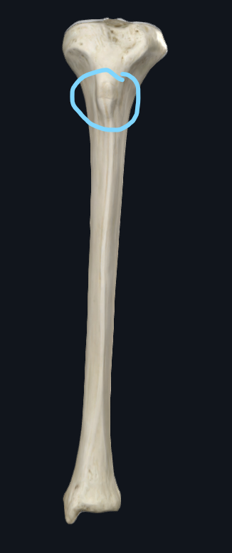 <p>What part of the tibia is this</p>