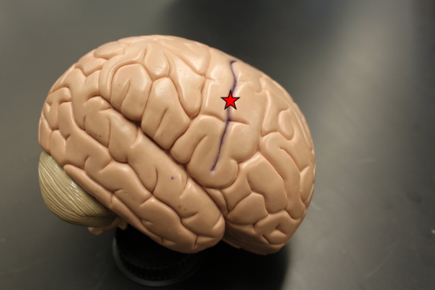 <p>A groove that divides the frontal and parietal lobes</p>