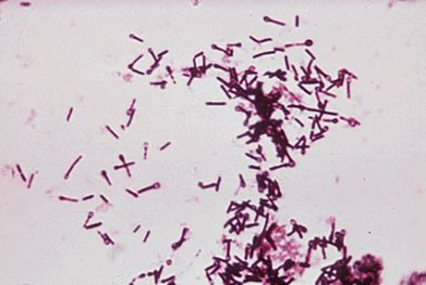 <p>Gram-positive rods (spore-forming)</p><p>Causes diarrhoea and enteritis</p><p>Zoonotic</p>
