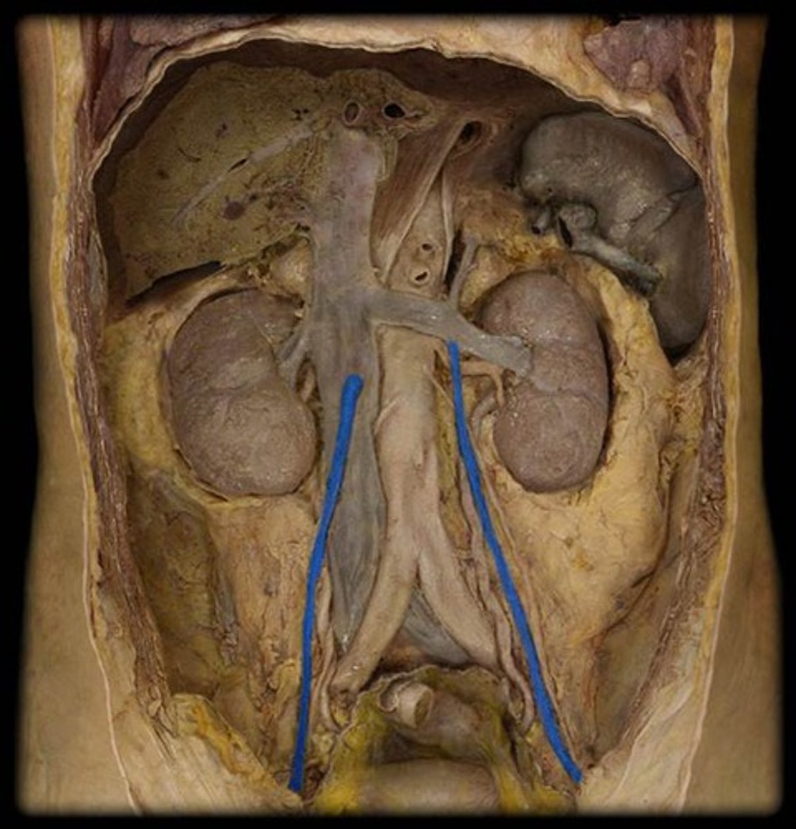 <p>Name these vessels.</p>