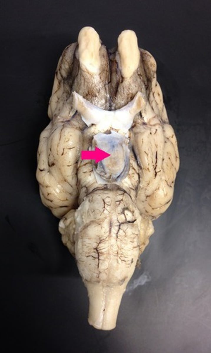 <p>Identify the structure.</p>