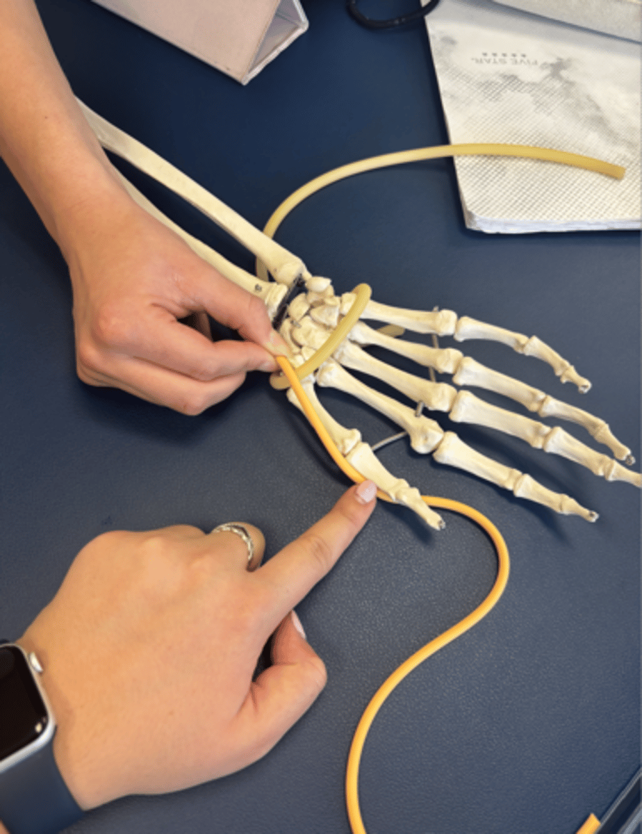 <p>What is this muscle?</p>