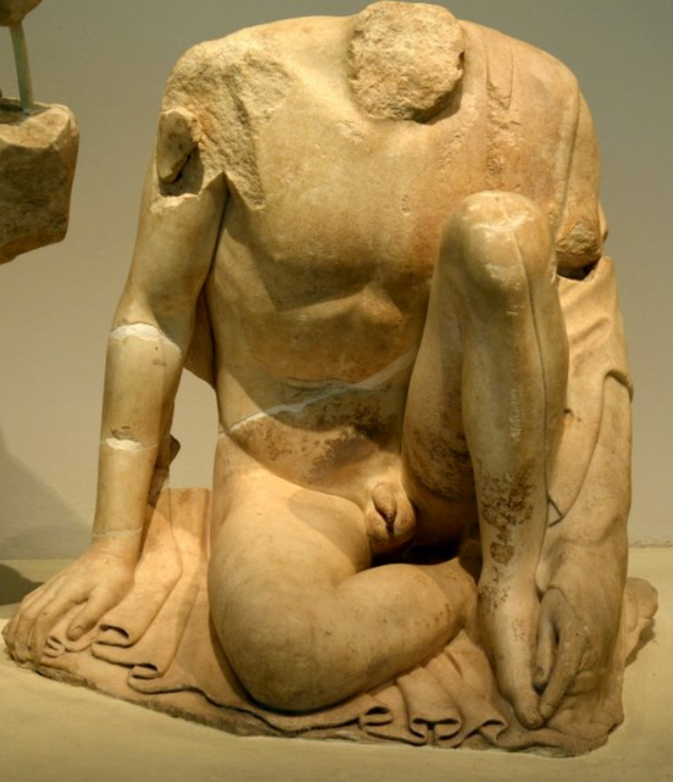 <p>How is detail created in the statue of the young boy left of the seer on the east pediment? What is his purpose? (3 POINTS)</p>