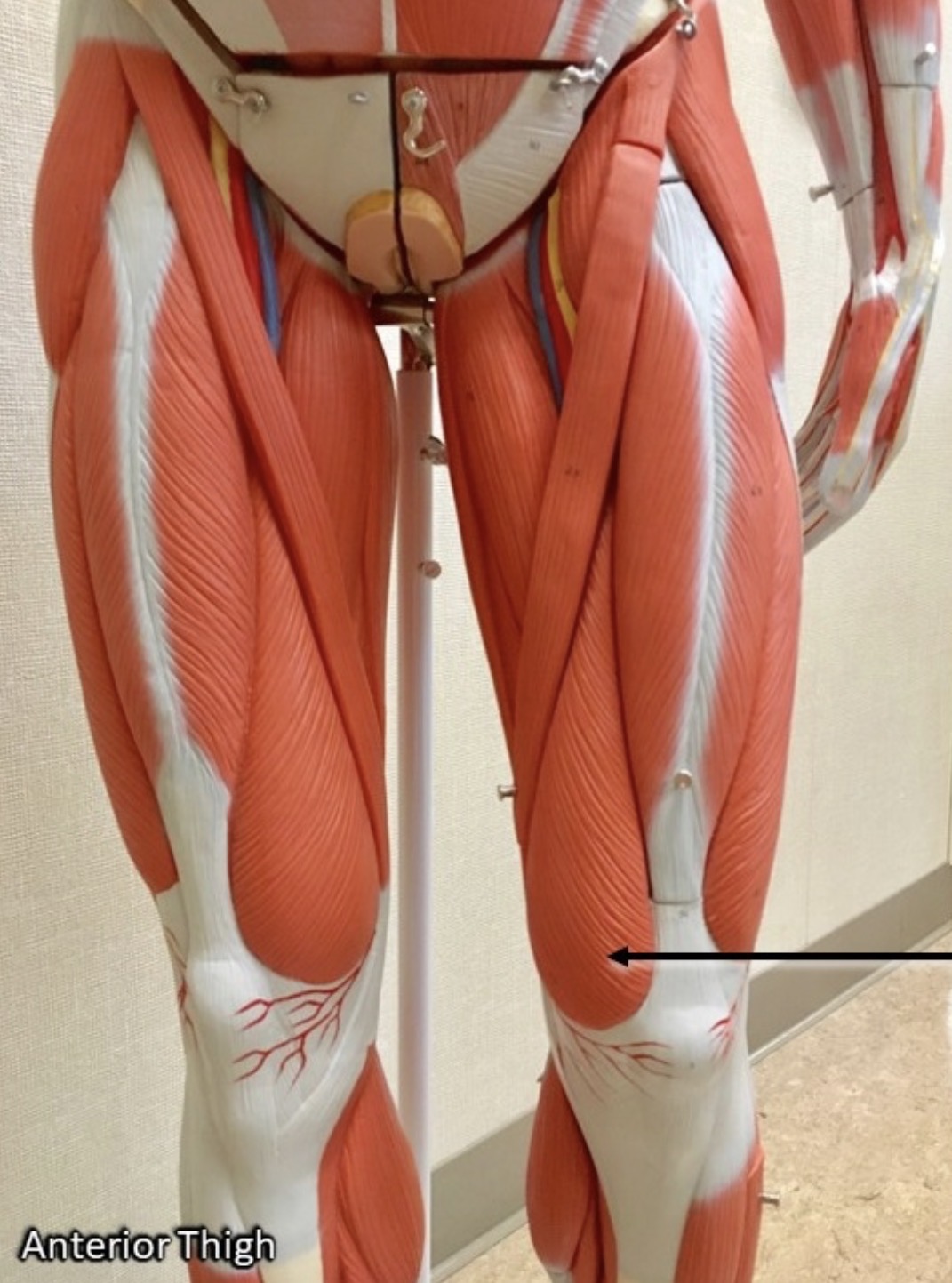 <p><span>Name the muscle labeled with the arrow below AND name the origin .</span></p>
