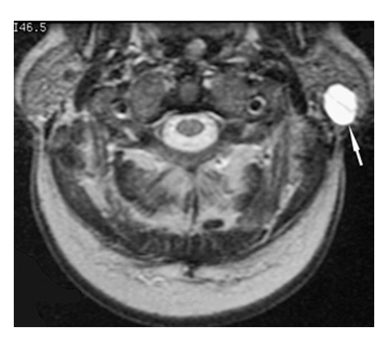 <p>What does the figure show?</p>