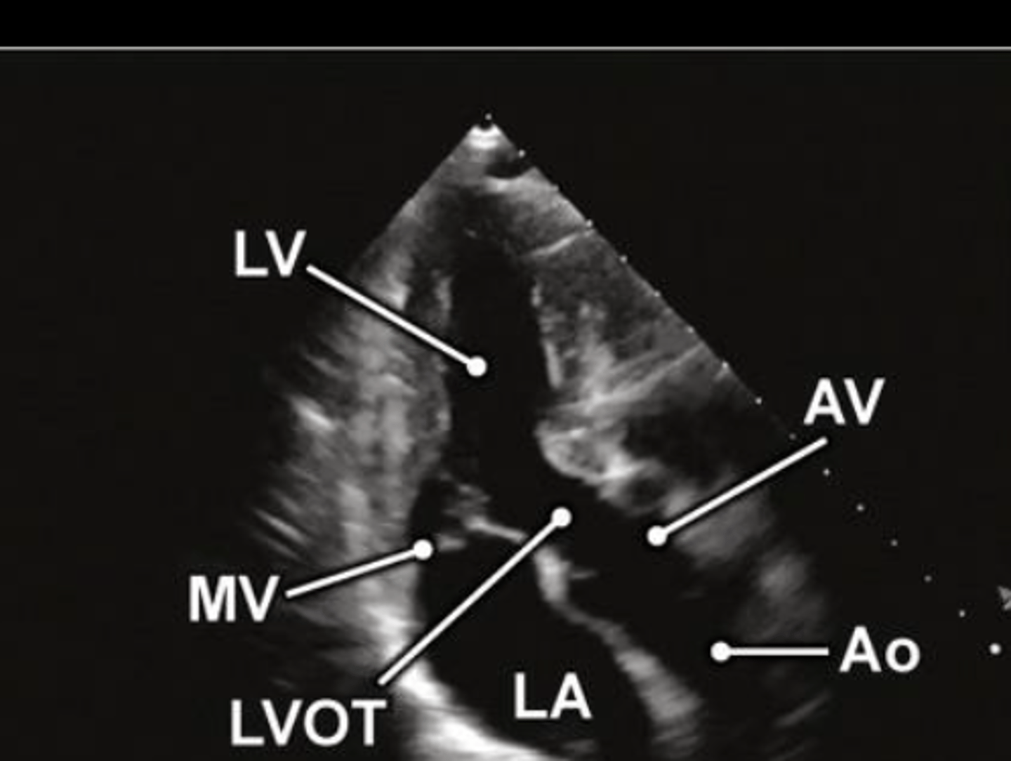 <p>A3 is used to visualize ___ and ____</p>