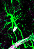 <ul><li><p>Type of <strong>glial cell</strong> that <strong>regulates BBB</strong>, coupling neuronal activity with <strong>metabolic support</strong> from blood, and interacts with other types of cells:</p><ul><li><p>Oligodendrocytes, microglia, blood vessels</p></li><li><p>Wraps around every blood vessel + capillary</p><p></p></li></ul></li></ul>