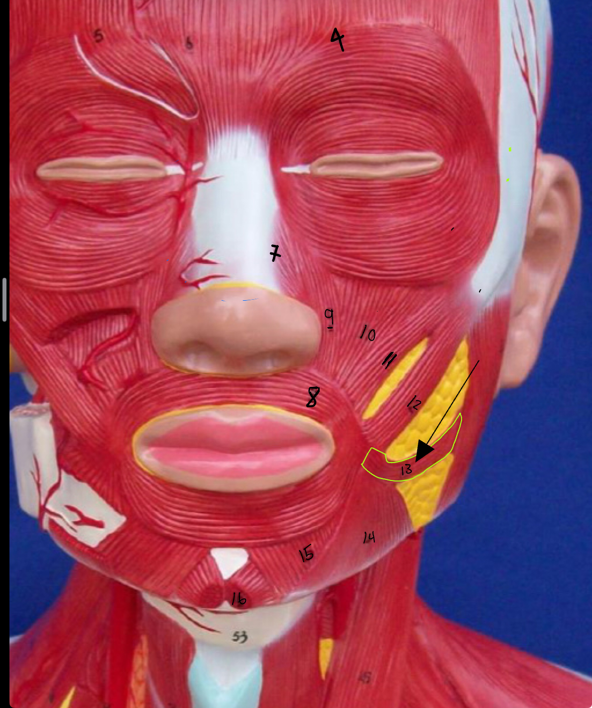 <p>what type of muscle is this</p>