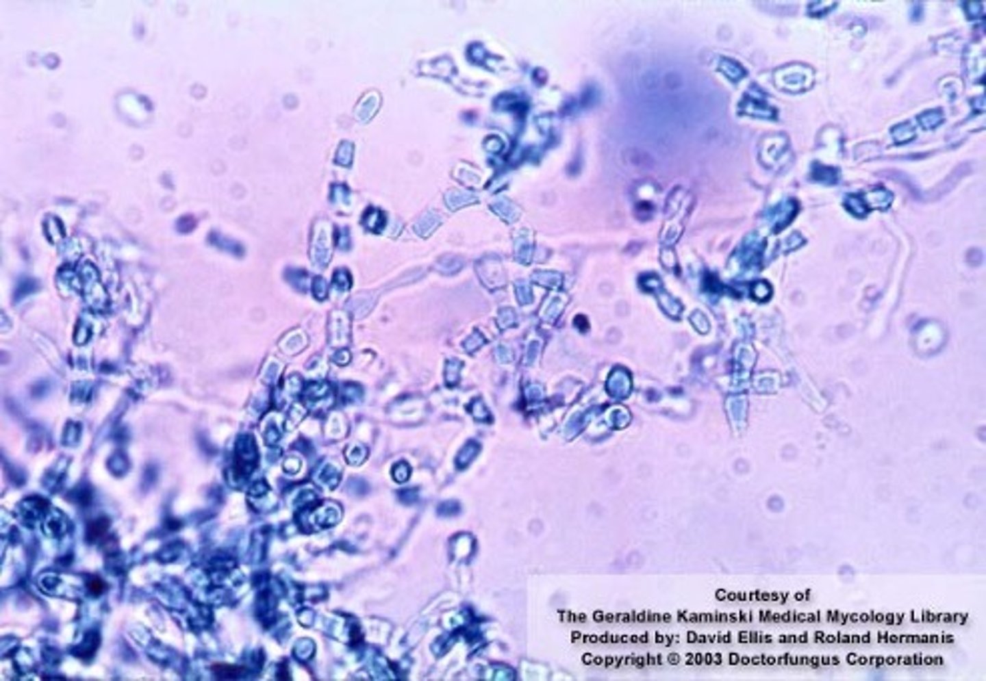 <p>(Mold form)</p>