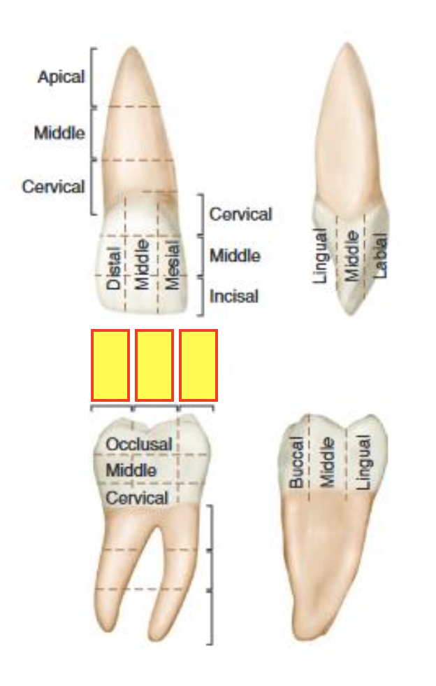 term image