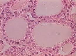 <p>hollow spheres lined by cuboidal epithelium, containing viscous colloid in cavity</p>