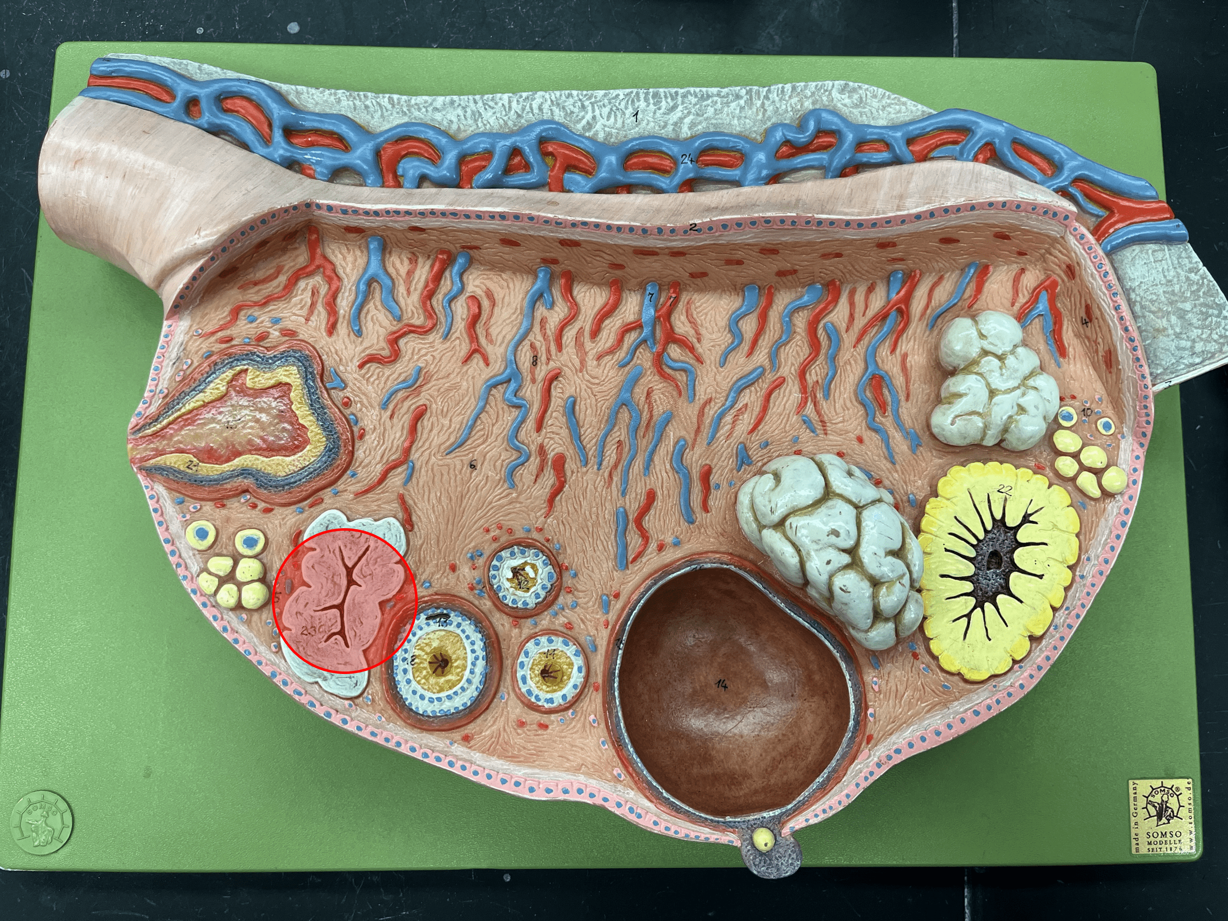 The degeneration of a corpus luteum if fertilization does not occur.