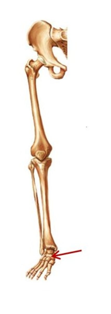 <p>ID bone group</p>