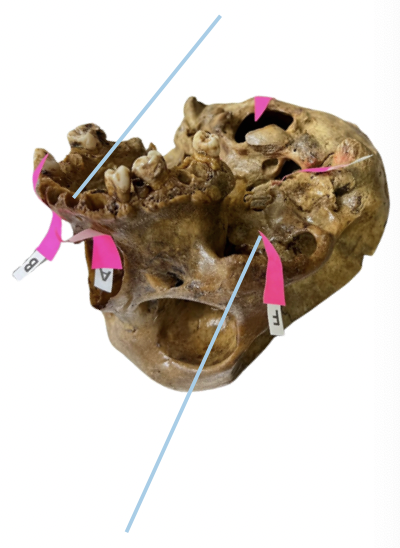 <p>Identify the structure of the skull labelled as A.</p>