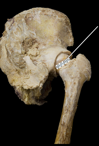 <p>Hip joint</p>