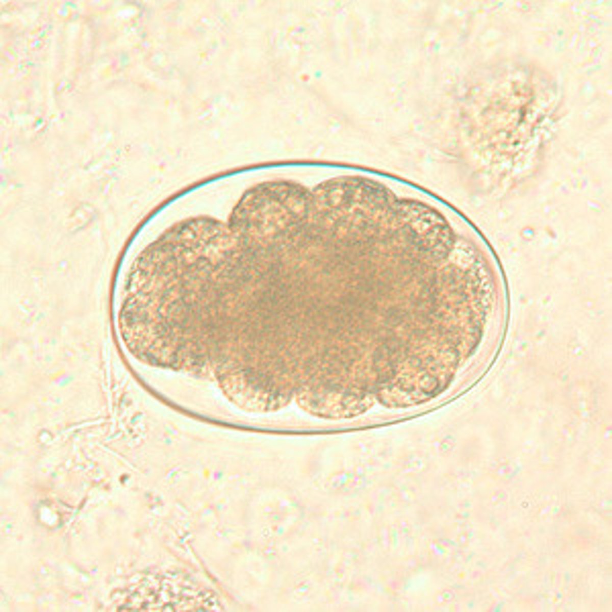 <p>• Egg</p><p>o Necatur and Ancylostoma</p><p>eggs are indistinguishable</p><p>o "Steak on a plate"</p>