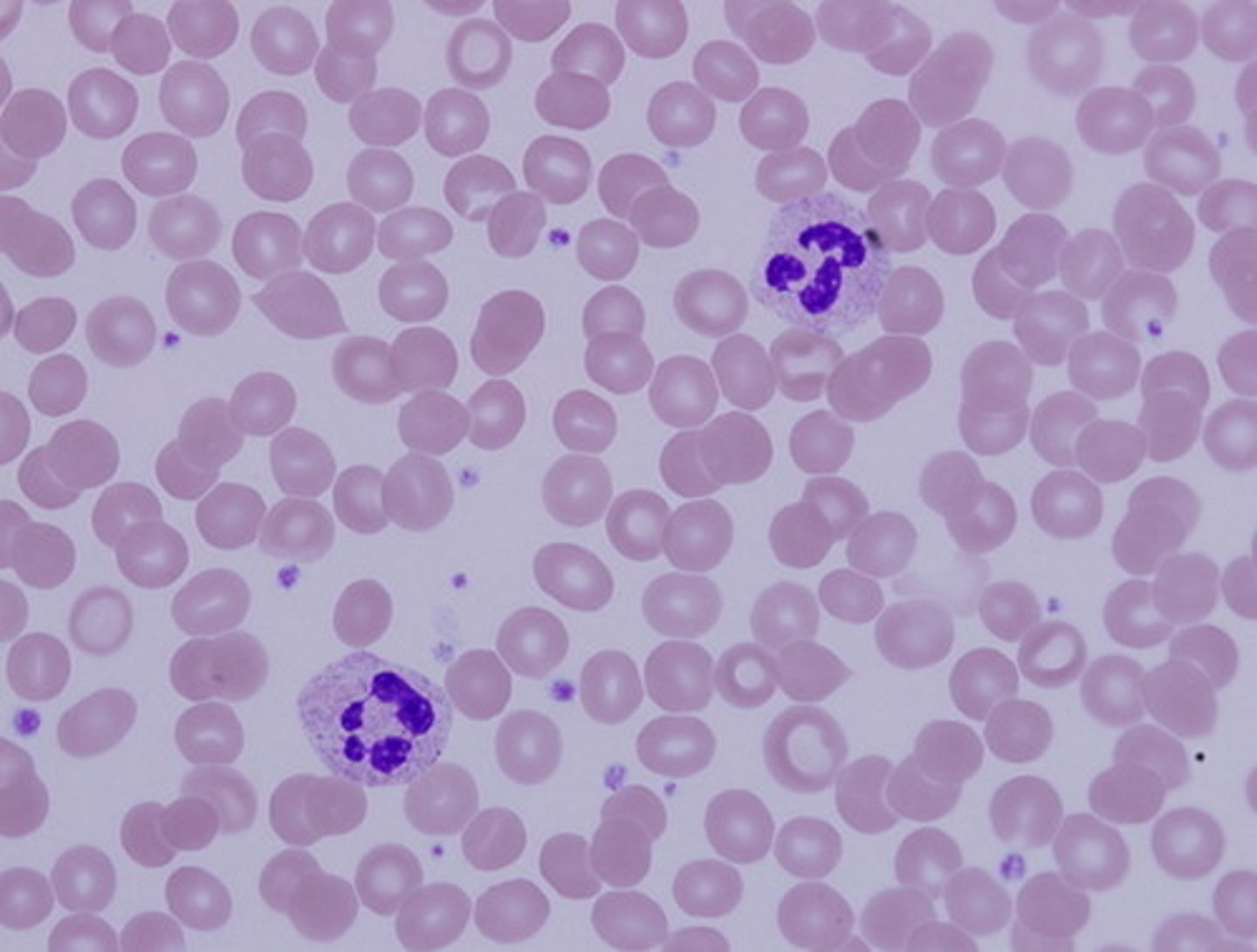 <p>red and white blood cells in a fluid matrix (plasma)</p>