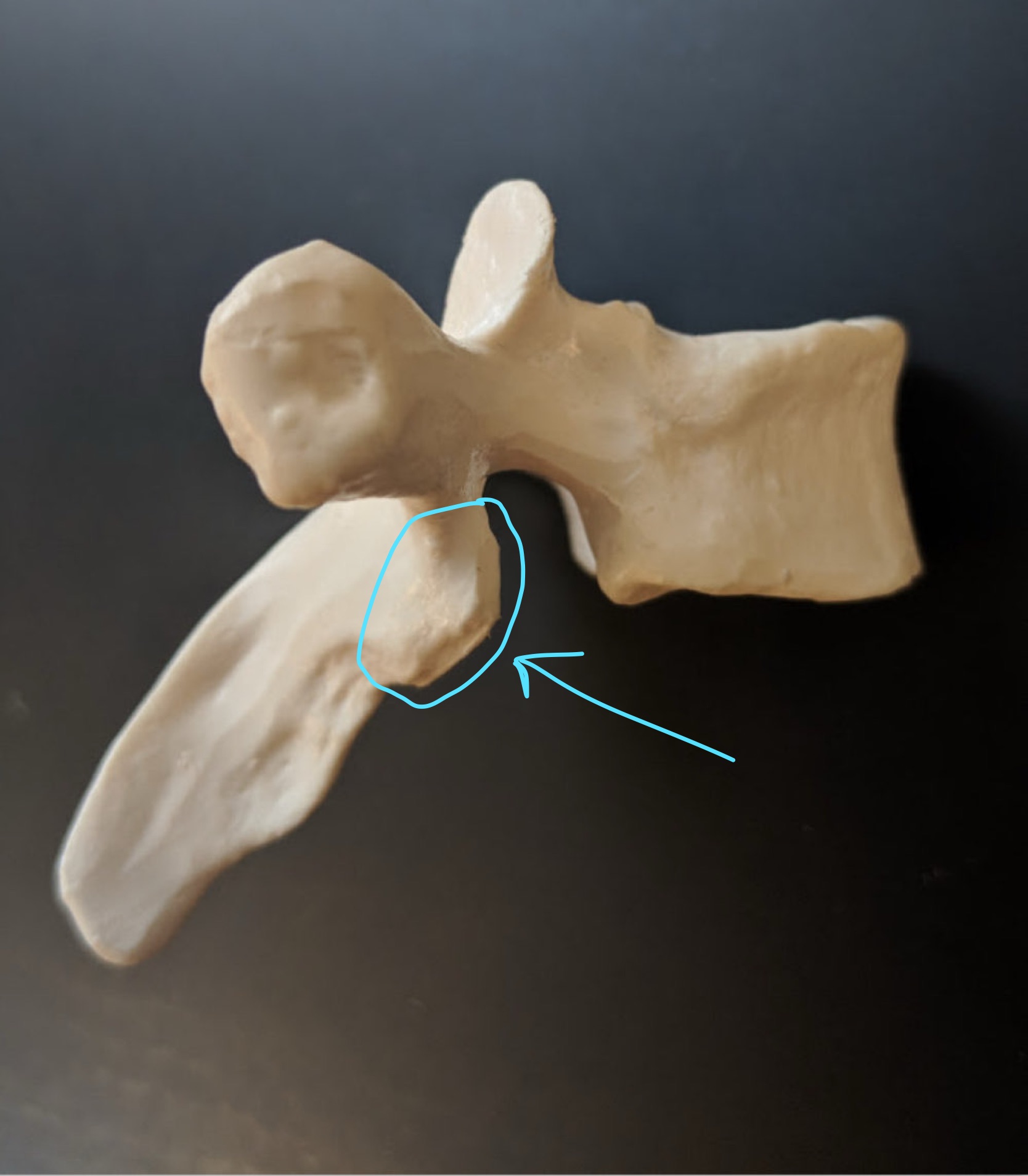 <p>Name this structure</p>