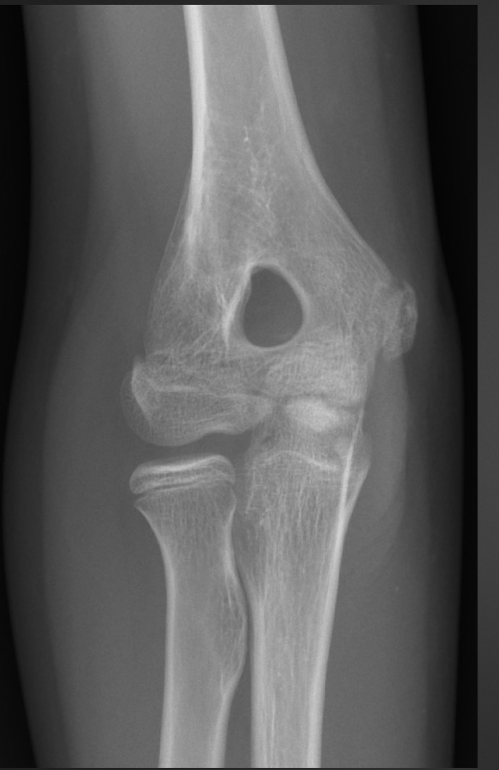 <p>what is this anomaly called </p>