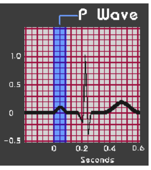 <p><strong>P Wave</strong></p><p>-Represents atrial ____________</p><p>-Count from beginning of wave to end of wave</p><p>-Should be &lt; 0.12 sec (&lt;_ small boxes), can also count half boxes</p>