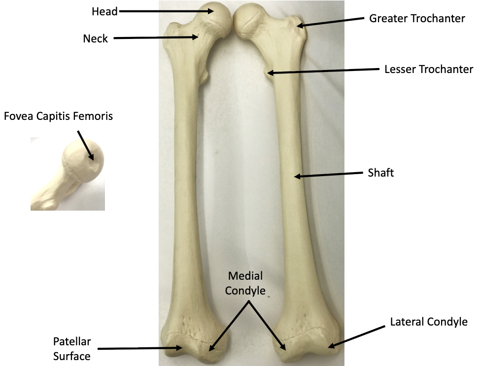<p>What bone is this? What view is it?</p>