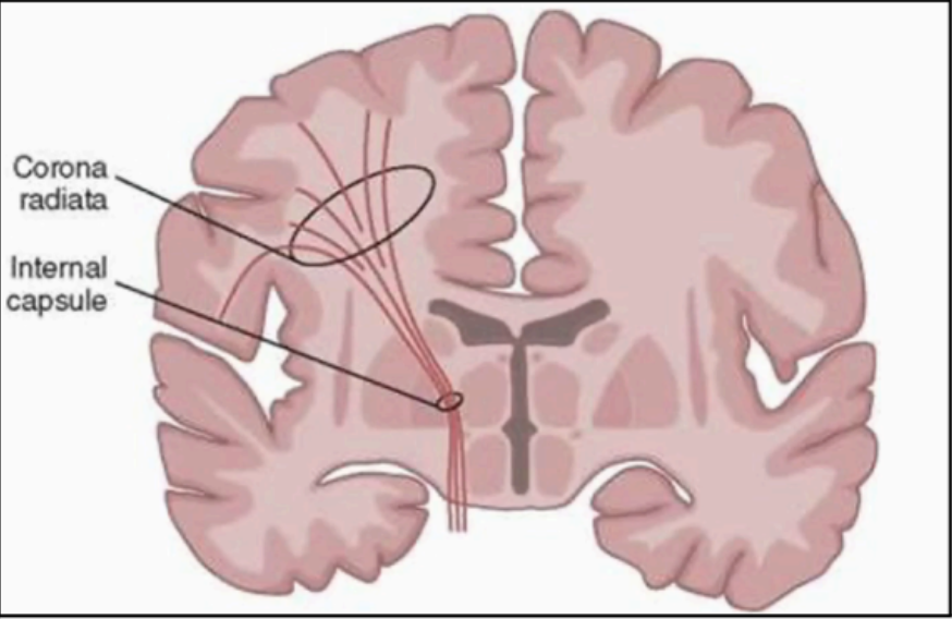 <p>Internal capsule</p>