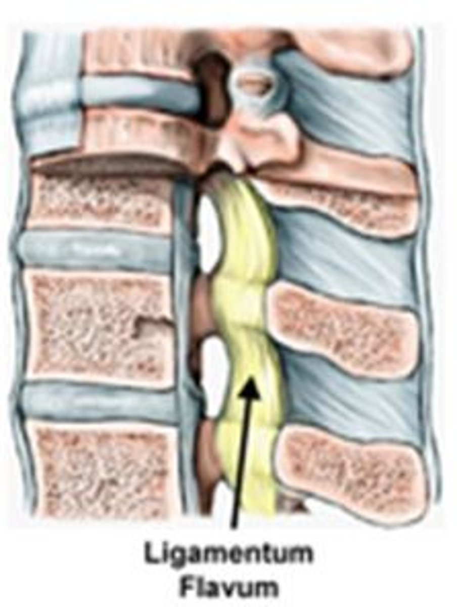 <p>yellow color; cervical; highest elastic content; vertebral to vertebral; prevent flexion</p>