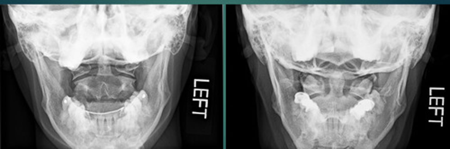 <p>What type of effect is this?</p>