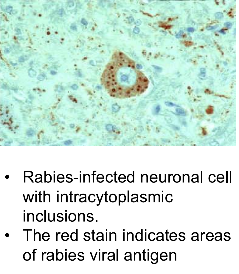 <ul><li><p>detects <strong>RABV antigens</strong></p></li><li><p>similar sensitivity as DFAT</p></li><li><p>can use formalin-fixed tissues</p></li><li><p>intracytoplasmic inclusions</p></li></ul><p></p>