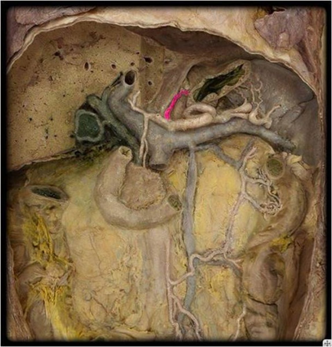 <p>Name this vessel (include the side).</p>