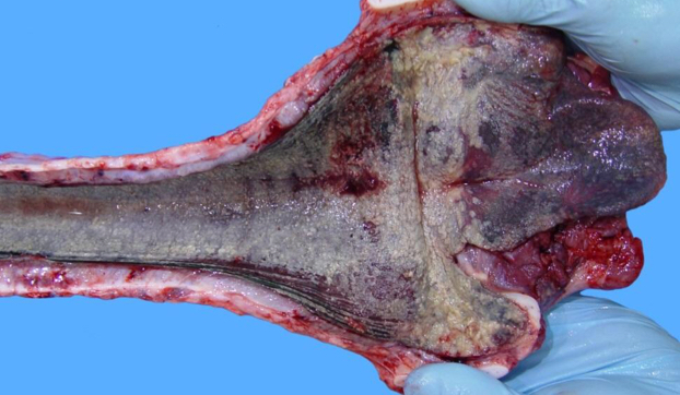 <ul><li><p>Bovine Herpesvirus-1 (BoHV-1)</p></li><li><p>Affects cattle</p></li><li><p>C.S</p><ul><li><p>Fever, nasal discharge, salivation</p></li></ul></li><li><p>Lesions</p><ul><li><p>Hyperemia (excess of blood in vessels)</p></li><li><p>Nasal/Tracheal <span style="color: rgb(207, 28, 28);"><strong><u>mucoal necrosis</u></strong></span></p><ul><li><p>Predisposes to 2° infections</p></li></ul></li></ul></li></ul><p></p>