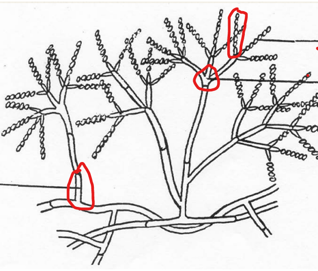 <p>Name the <strong>Parts of Hyphae</strong></p>