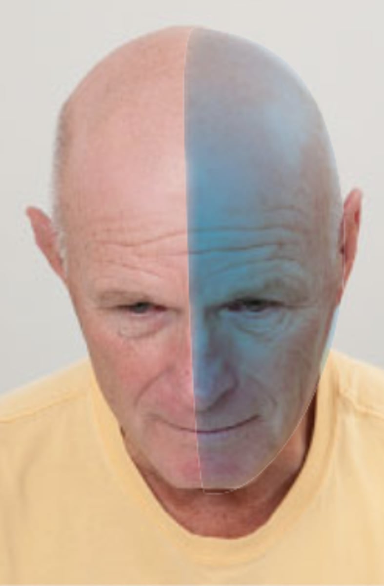 <p>n /ˈmiː.ɡreɪn/ chứng đau nửa đầu Migraines can severely affect a person's ability to concentrate and work.</p>